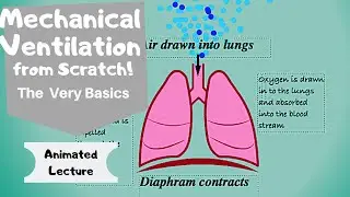 Mechanical Ventilation (basic principles)