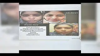 Skin formation 9 Skin care all types of use  contact us 9655345599