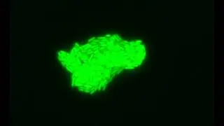 Growing bacteria w. GFP reporter
