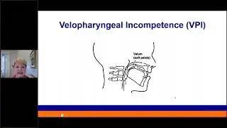 Speech pathologist's role in Cleft care and Velopharyngeal Insufficiency management