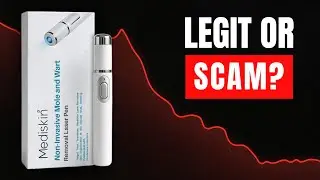 MediSkin Laser Review &ndash; Scam or Legit?