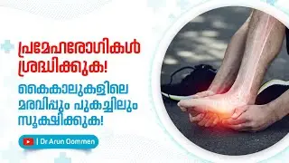 കൈകാലുകളുടെ ബലക്ഷയം, കൂടുതൽ&nbsp;അറിയാം | Dr Arun Oommen #drtalks