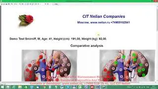 063 ENG Dianel 2 software, VRT test External + VRT of Etalon + comparative analysis + Report print