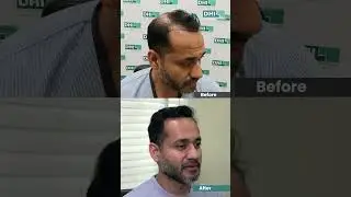 These aren&rsquo;t just before after. They&rsquo;re the result of doing it the right way