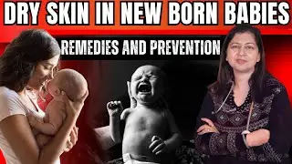 Dry Skin in Newborn Babies : Causes, Home Care & Dermatologist Tips | Why does baby's skin get dry |
