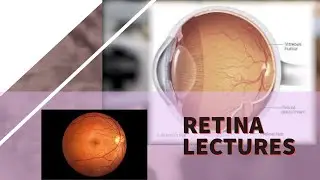 RETINA lecture 18 RETINOPATHY OF PREMATURITY (pathogenesis, zones of retina) in detail