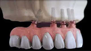 matrix&reg; ProFlex