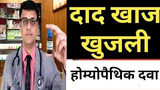 ringworm treatment / दाद खाज खुजली की दवा /homeopathic treatment