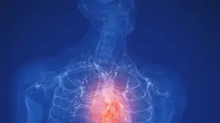 Early Detection of Heart Disease