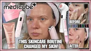 MEDICUBE Skincare Routine That Transformed My Skin | Step-by-Step Guide RF ULTRA TUNE | Clare Walch