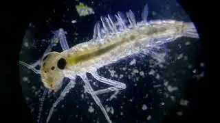 Mayfly larvae | Under Microscope @40X