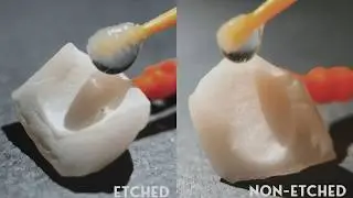 Lithium Disilicate (EMAX) Etched vs Non-Etched