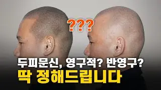 두피문신 오래가나요? 실제 유지기간, 솔직히 다 말합니다.