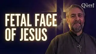 The Quest: Fetal Face of Jesus (Portrait)