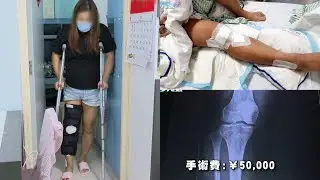 港女深圳水療跌致韌帶撕裂水療中心只肯負責一半醫療費用