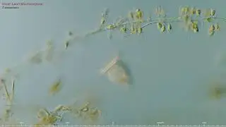 Peritrich ciliate