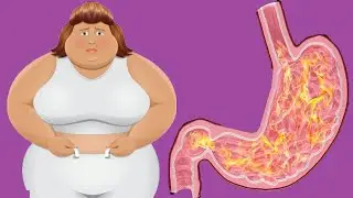 Swollen Stomach: Causes And Prevention
