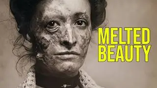 The Beauty Treatment That Melted Faces: Victorian 