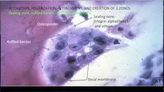 Learning Bone Growth 3:  The Osteoclast