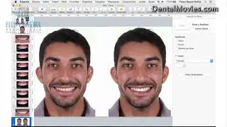 DSD   Digital Smile Design by Felipe Miguel   Dental Movies 1080p, vp9