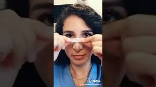 Rhinoplasty Taping at Orlando Facial Plastics