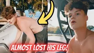 Jack Doherty Nearly Loses His Leg in Boating Crash Gone Wrong!