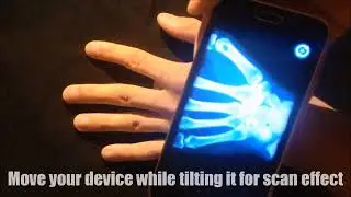 Xray Body Scanner