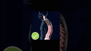 Smart Posture Corrector