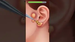 Ear Pimple Removal ASMR Animation || #asmr  #shorts #animation  #treatment  #eartreatment