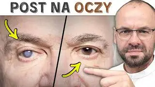 Ten post poprawia WZROK lepiej niż okulary!