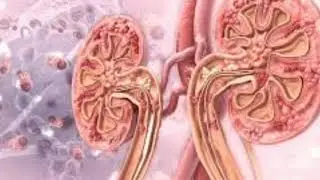 Researchers identify biomarker for early deduction of diabetic kidney failure
