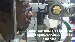 IOP Eye test visual fields  glaucoma awareness to prevent  blindness 