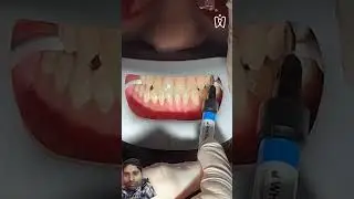 Best dant color 1mil #dentalturkey #smile