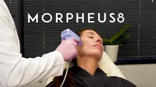 Morpheus8 Face and Neck Tightening in Dallas-Fort Worth | Amor Propio Aesthetic Surgery