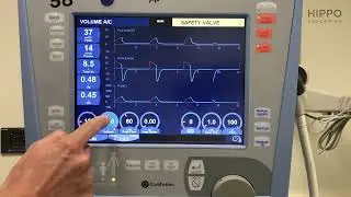 Basic Ventilator Knobology and COVID Settings