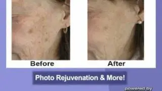 Lougheed Laser Centre - (604)421-3111