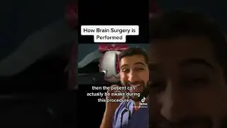 How Brain Surgery is Performed #healthcare
