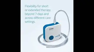 Why choose a NPWT Pump with up to 30-day lifespan