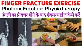 Finger Fracture Exercises | Phalanx Fracture Exercises | Finger Fracture Physiotherapy Exercise