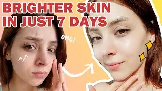 #ТемныеПятна: путь Луизы к более яркой коже с APRILSKIN