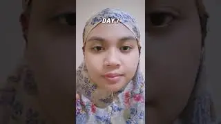 Jangan Pakai Serum Ini Kalau Gak Mau Kulitmu Pumply Dan Lebih Cerah.