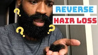 How I REVERSED and STOPPED My Hair Loss | Black Men's Hair Loss