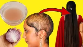 ঘন কালো লম্বা চুল ফিরে পাবে ১ সপ্তাহেই!এটি সপ্তাহে মাত্র দু’দিন লাগাও আর ম্যাজিক দেখো🤩/Hair remedy