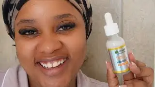 Сыворотка с витамином С от Garnier &ndash; это все, что вам нужно для сияния кожи 🍋✨ | Удаляет темные п...