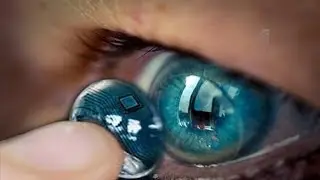 Google Unveils Smart Contact Lens with glucose sensor for Diabetics checkup