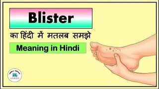 Blisters Meaning in Hindi | What Does &lsquo;Blisters&rsquo; Mean? | English Word Explained in Hindi