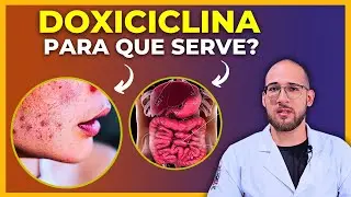 DOXICICLINA - Para que serve? Efeitos colaterais? Contraindica&ccedil;&otilde;es? Tudo sobre esse antibi&oacute;tico!
