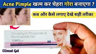 Clinsol Gel Review !! Acne Pimple ko khatam kar chehra gora banayega !! 
