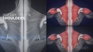 The Best Exercises for Your Shoulders | WebMD