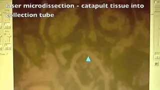 Laser capture microdissection of a tomato placenta